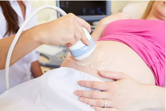 上海妇产医院如何让胎宝宝配合四维彩超检查？