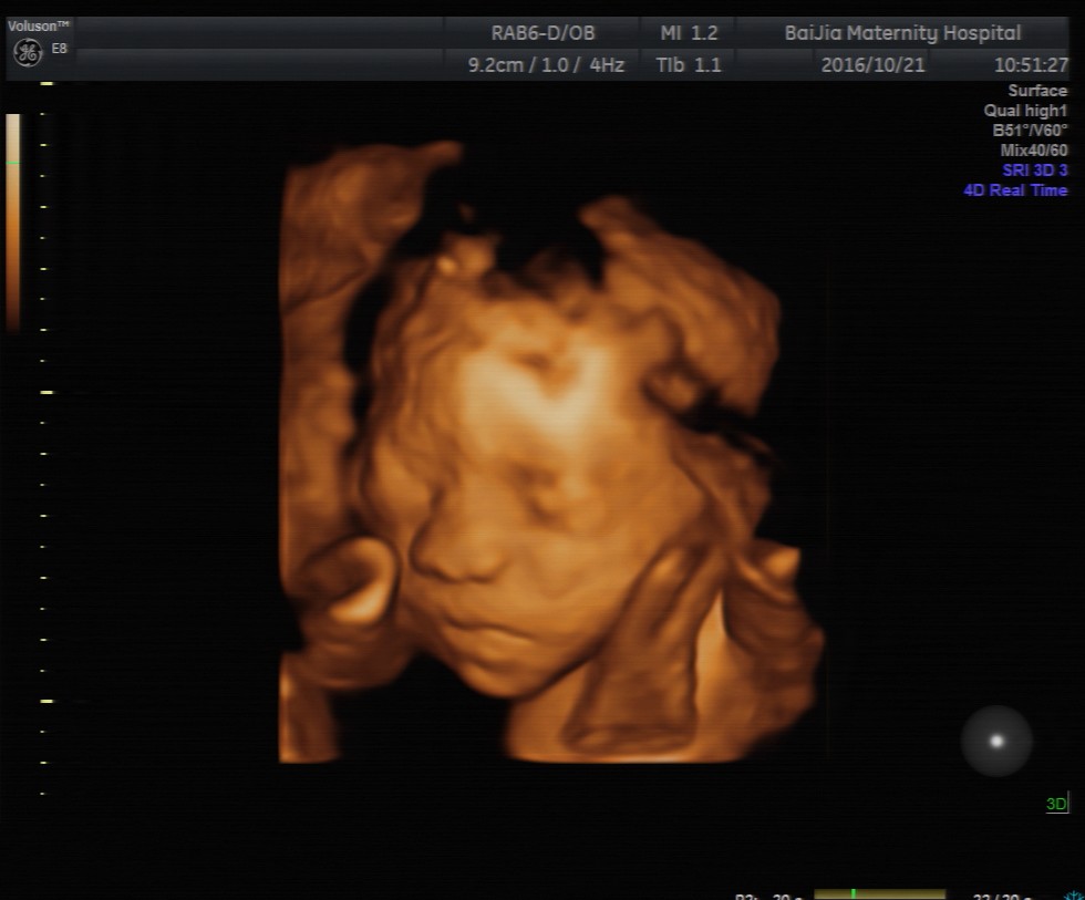 上海百佳妇产医院